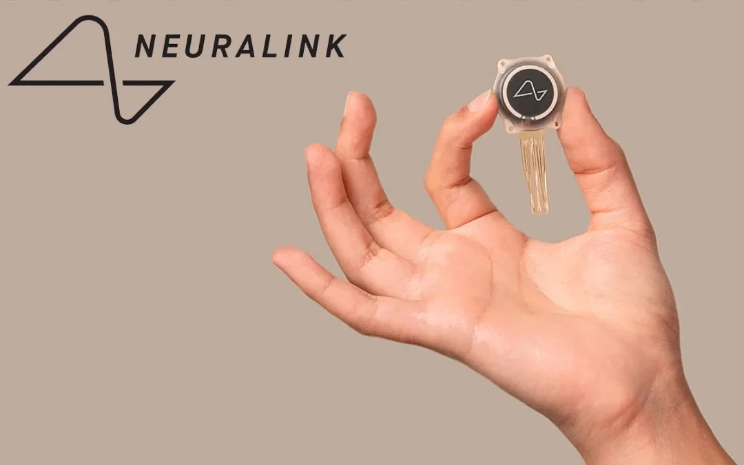Elon Musk의 Neuralink 뇌 이식 첫 시도